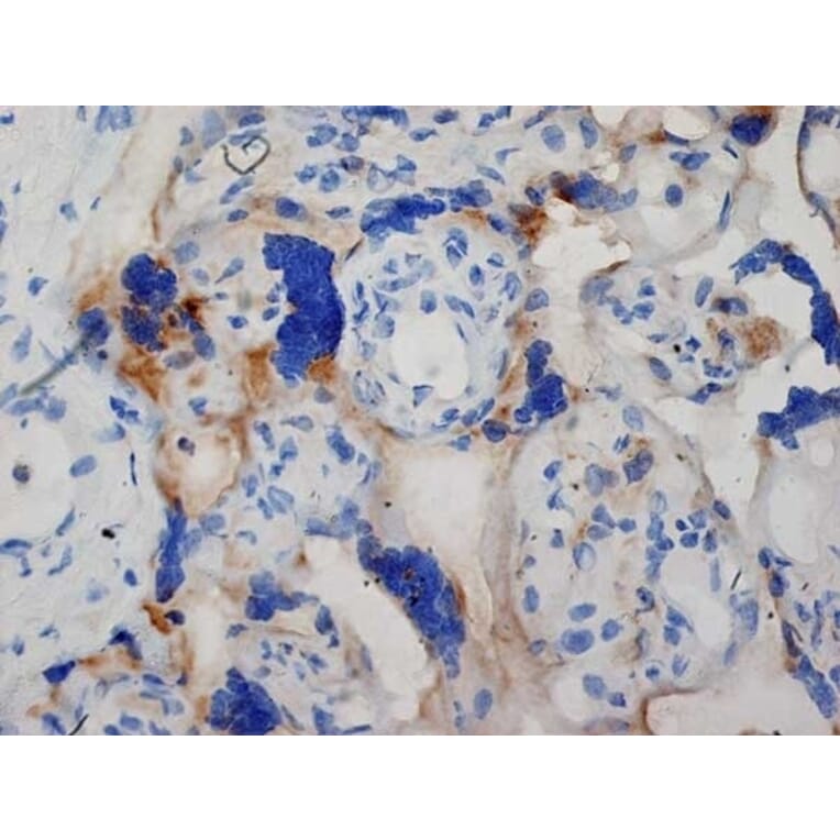 Immunohistochemistry - Anti-Inhibin alpha Antibody [R1] (A281621) - Antibodies.com