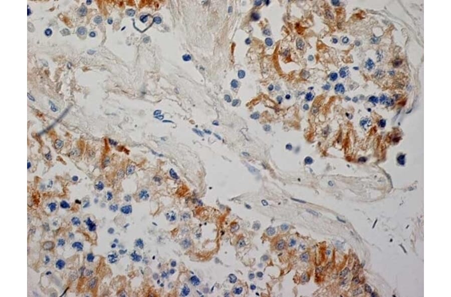 Immunohistochemistry - Anti-Inhibin alpha Antibody [R1] (A281621) - Antibodies.com