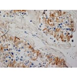 Immunohistochemistry - Anti-Inhibin alpha Antibody [R1] (A281621) - Antibodies.com