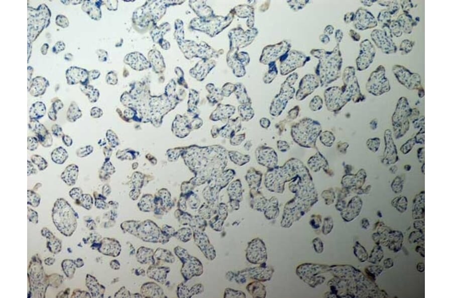 Immunohistochemistry - Anti-Inhibin alpha Antibody [R1] (A281621) - Antibodies.com