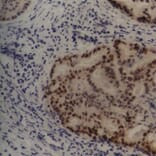 Flow Cytometry - Anti-MDM2 Antibody [SMP14] (A281750) - Antibodies.com