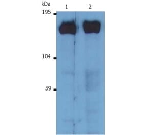 Western Blot - Anti-SOS1 Antibody [SOS-01] (A281774) - Antibodies.com
