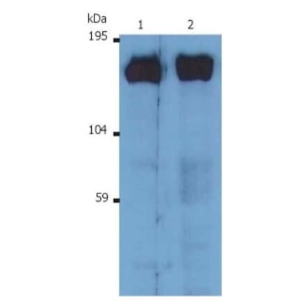 Western Blot - Anti-SOS1 Antibody [SOS-01] (A281774) - Antibodies.com