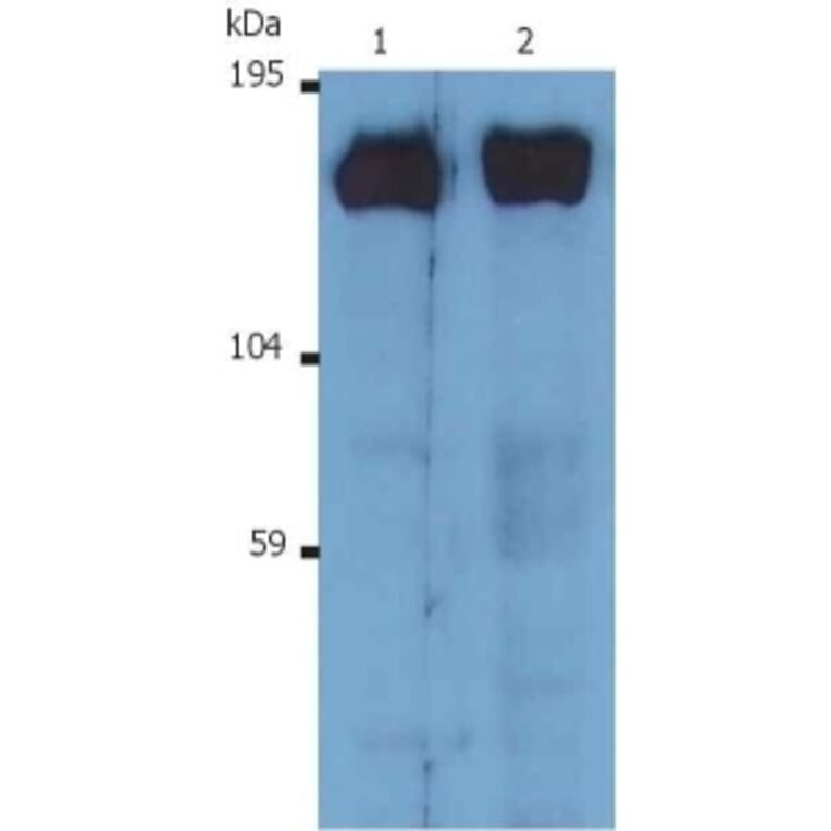 Western Blot - Anti-SOS1 Antibody [SOS-01] (A281774) - Antibodies.com