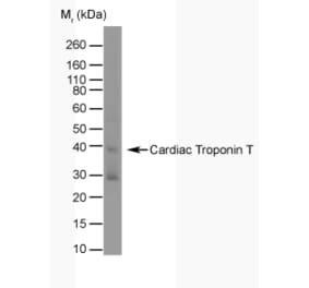 Western Blot - Anti-Cardiac Troponin T Antibody [TT44 (BGN/1288/44)] (A281848) - Antibodies.com