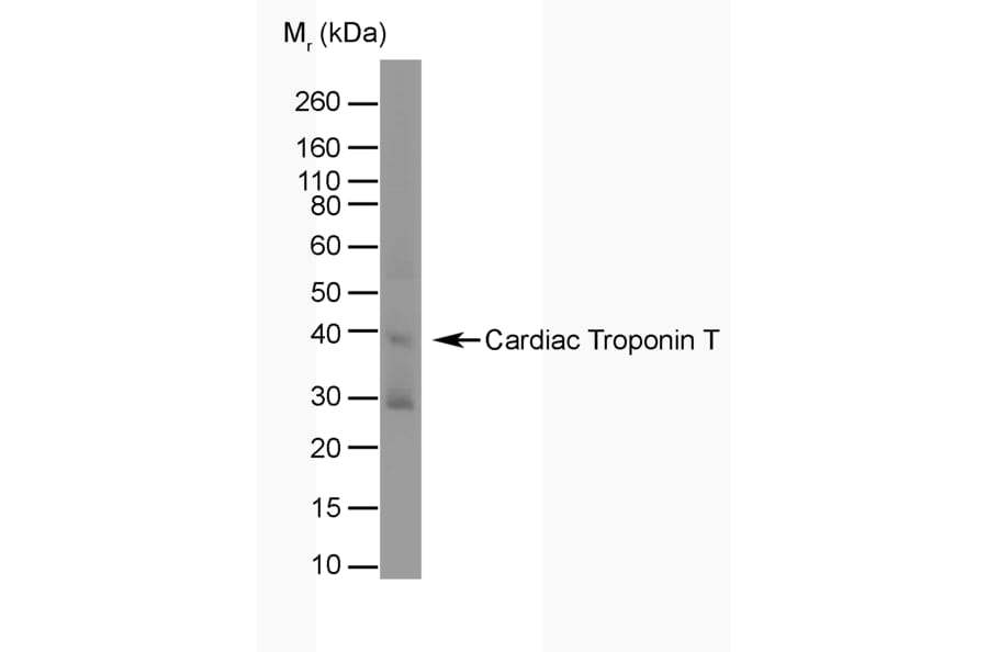 Western Blot - Anti-Cardiac Troponin T Antibody [TT44 (BGN/1288/44)] (A281848) - Antibodies.com