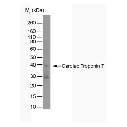 Western Blot - Anti-Cardiac Troponin T Antibody [TT44 (BGN/1288/44)] (A281848) - Antibodies.com