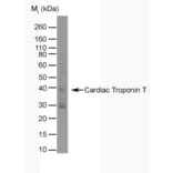 Western Blot - Anti-Cardiac Troponin T Antibody [TT44 (BGN/1288/44)] (A281848) - Antibodies.com