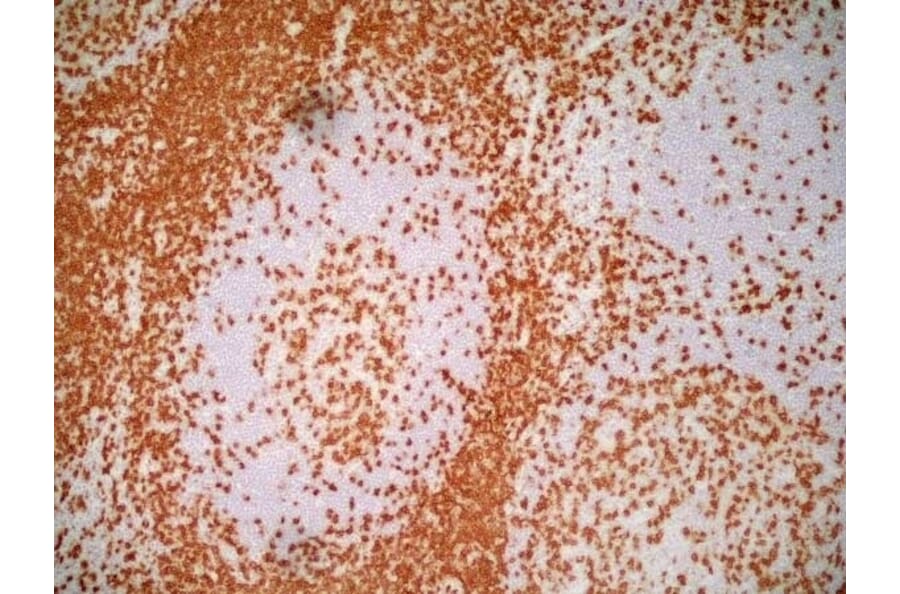 Immunohistochemistry - Anti-CD3 epsilon Antibody [UCHT1] (A281885) - Antibodies.com