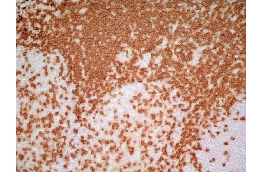 Immunohistochemistry - Anti-CD3 epsilon Antibody [UCHT1] (A281885) - Antibodies.com