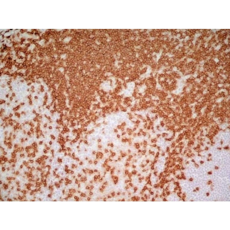 Immunohistochemistry - Anti-CD3 epsilon Antibody [UCHT1] (A281885) - Antibodies.com