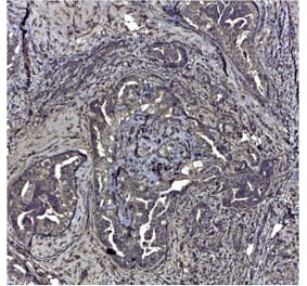 Immunohistochemistry - Anti-CD44v6 Antibody [VFF-7] (A281912) - Antibodies.com