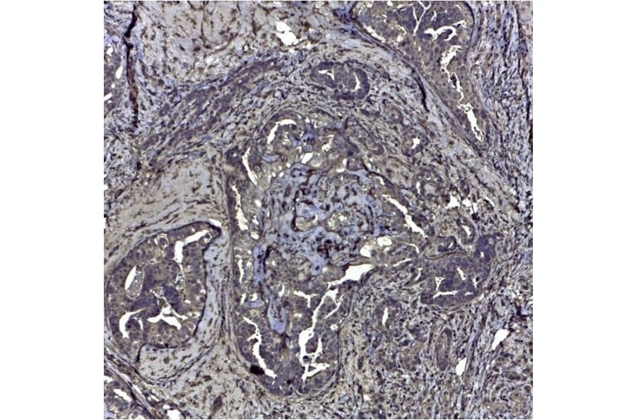 Immunohistochemistry - Anti-CD44v6 Antibody [VFF-7] (A281912) - Antibodies.com