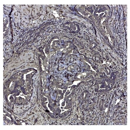 Immunohistochemistry - Anti-CD44v6 Antibody [VFF-7] (A281912) - Antibodies.com