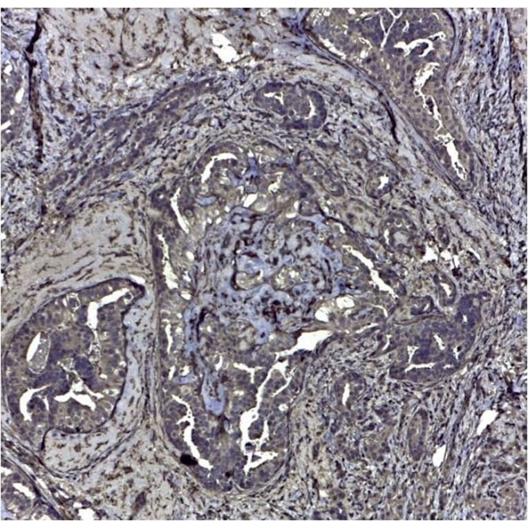 Immunohistochemistry - Anti-CD44v6 Antibody [VFF-7] (A281912) - Antibodies.com