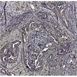 Immunohistochemistry - Anti-CD44v6 Antibody [VFF-7] (A281912) - Antibodies.com
