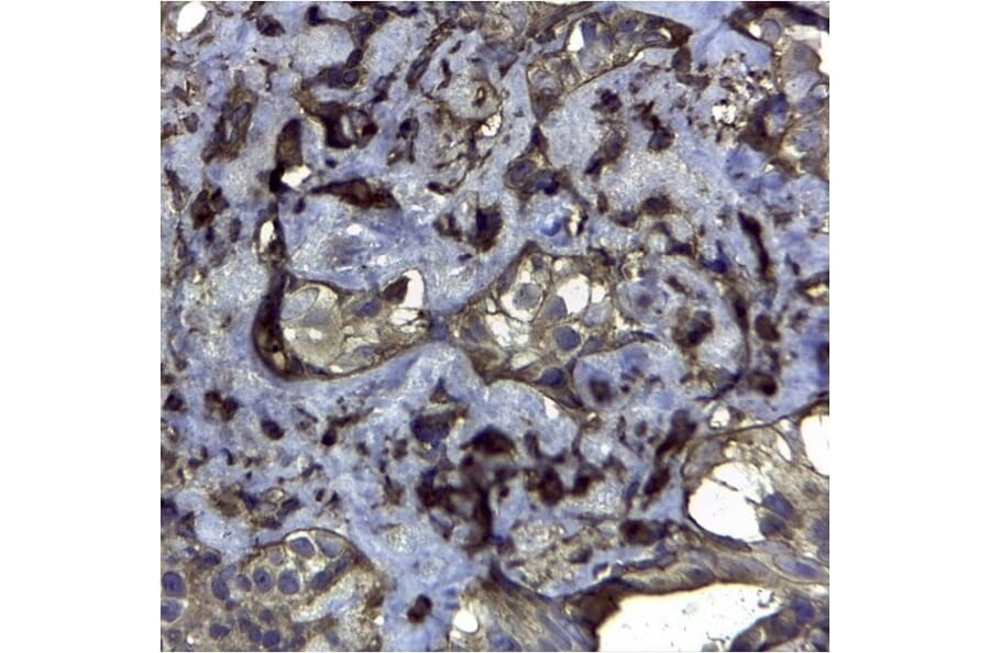 Immunohistochemistry - Anti-CD44v6 Antibody [VFF-7] (A281912) - Antibodies.com