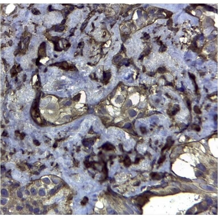 Immunohistochemistry - Anti-CD44v6 Antibody [VFF-7] (A281912) - Antibodies.com