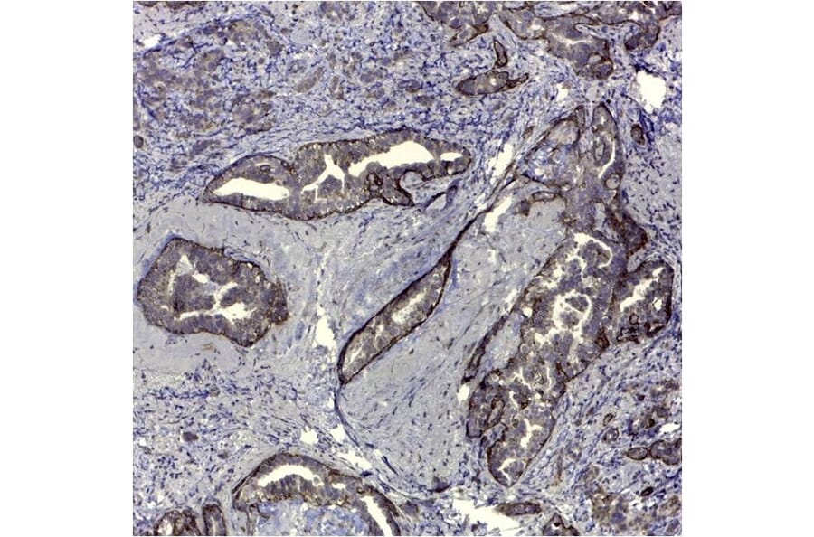 Immunohistochemistry - Anti-CD44v5 Antibody [VFF-8] (A281913) - Antibodies.com