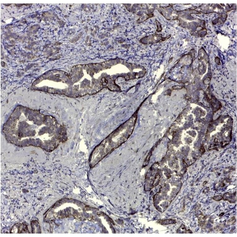 Immunohistochemistry - Anti-CD44v5 Antibody [VFF-8] (A281913) - Antibodies.com