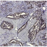 Immunohistochemistry - Anti-CD44v5 Antibody [VFF-8] (A281913) - Antibodies.com