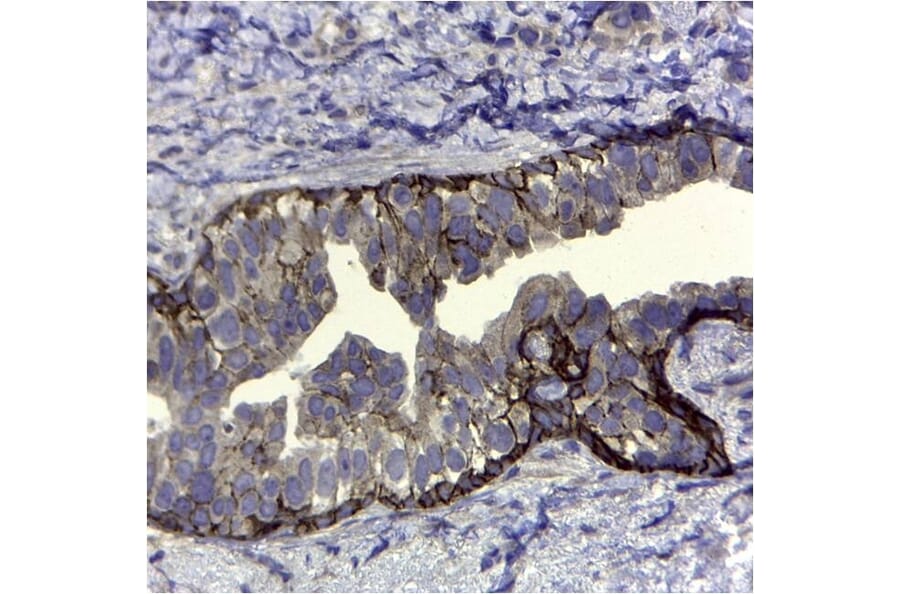 Immunohistochemistry - Anti-CD44v5 Antibody [VFF-8] (A281913) - Antibodies.com