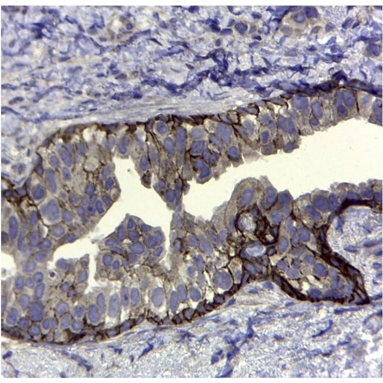 Immunohistochemistry - Anti-CD44v5 Antibody [VFF-8] (A281913) - Antibodies.com