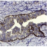 Immunohistochemistry - Anti-CD44v5 Antibody [VFF-8] (A281913) - Antibodies.com
