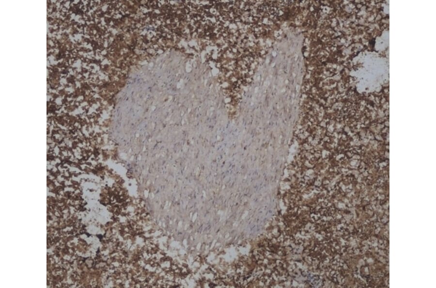 Immunohistochemistry - Anti-CD45 Antibody [VPM18] (A281930) - Antibodies.com