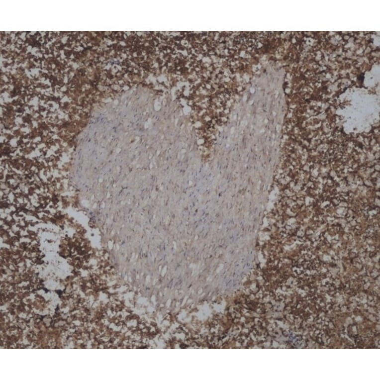 Immunohistochemistry - Anti-CD45 Antibody [VPM18] (A281930) - Antibodies.com