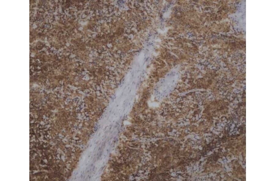 Immunohistochemistry - Anti-CD45 Antibody [VPM18] (A281930) - Antibodies.com