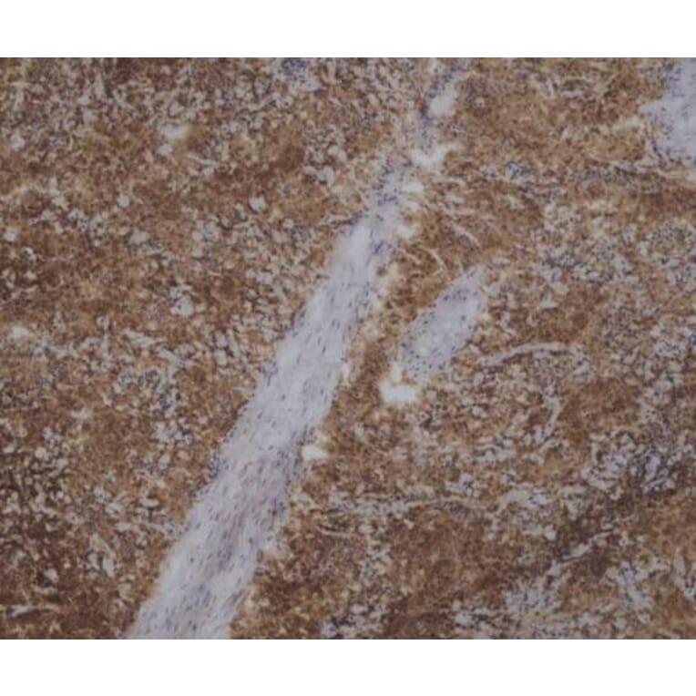 Immunohistochemistry - Anti-CD45 Antibody [VPM18] (A281930) - Antibodies.com