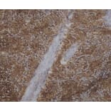 Immunohistochemistry - Anti-CD45 Antibody [VPM18] (A281930) - Antibodies.com