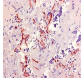 Immunohistochemistry - Anti-Aspergillus Antibody [WF-AF-1] (A281971) - Antibodies.com