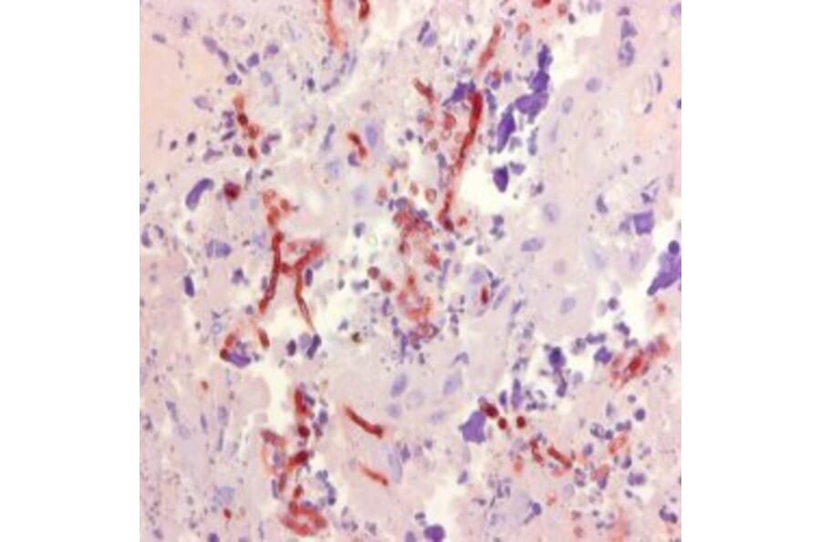Immunohistochemistry - Anti-Aspergillus Antibody [WF-AF-1] (A281971) - Antibodies.com