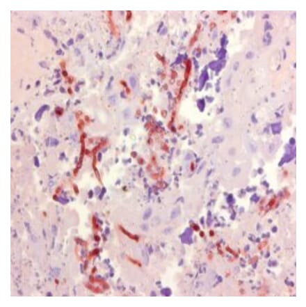Immunohistochemistry - Anti-Aspergillus Antibody [WF-AF-1] (A281971) - Antibodies.com