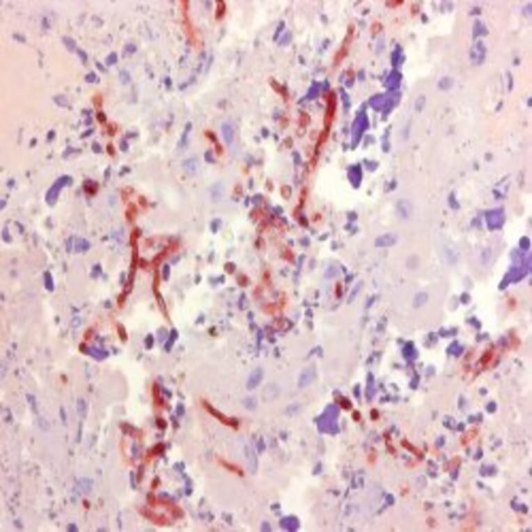Immunohistochemistry - Anti-Aspergillus Antibody [WF-AF-1] (A281971) - Antibodies.com