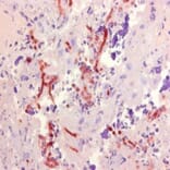 Immunohistochemistry - Anti-Aspergillus Antibody [WF-AF-1] (A281971) - Antibodies.com