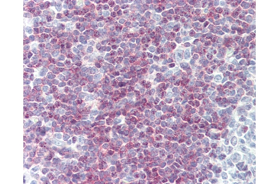 Immunohistochemistry - Anti-CD79a Antibody [ZL7-4] (A282128) - Antibodies.com
