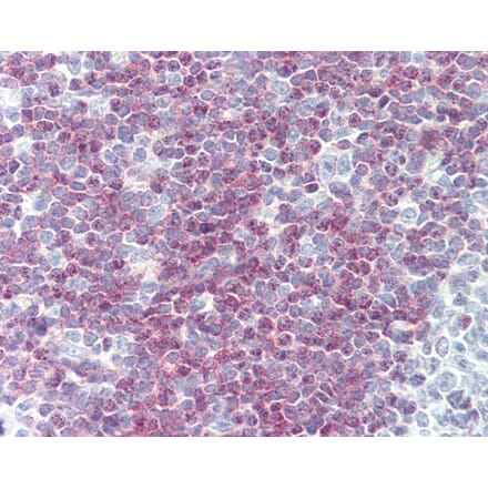 Immunohistochemistry - Anti-CD79a Antibody [ZL7-4] (A282128) - Antibodies.com