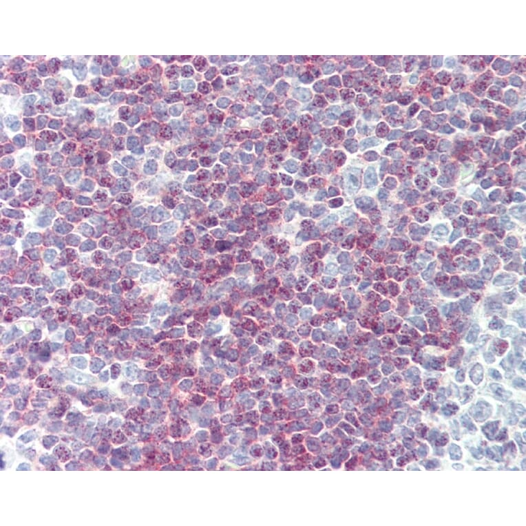 Immunohistochemistry - Anti-CD79a Antibody [ZL7-4] (A282128) - Antibodies.com