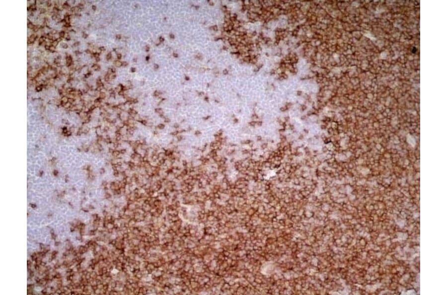 Immunohistochemistry - Goat Anti-Mouse IgG1 Antibody (HRP) (A282595) - Antibodies.com