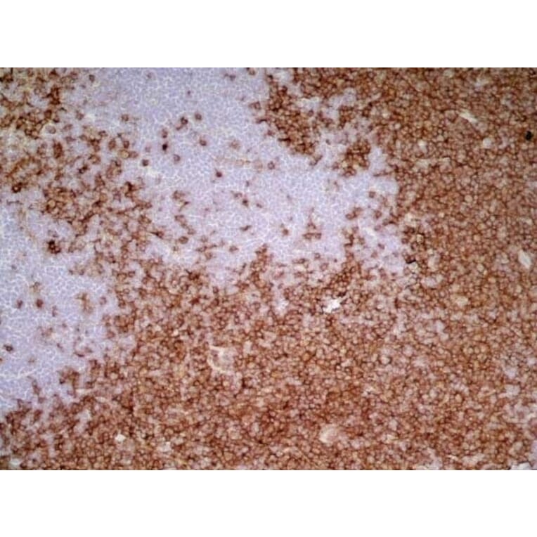 Immunohistochemistry - Goat Anti-Mouse IgG1 Antibody (HRP) (A282595) - Antibodies.com
