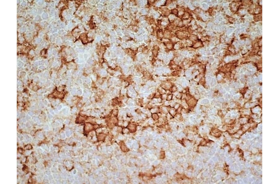 Immunohistochemistry - Goat Anti-Mouse IgG2a Antibody (HRP) (A282596) - Antibodies.com