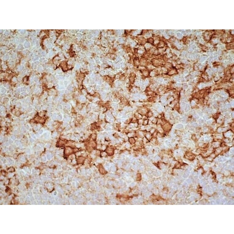 Immunohistochemistry - Goat Anti-Mouse IgG2a Antibody (HRP) (A282596) - Antibodies.com