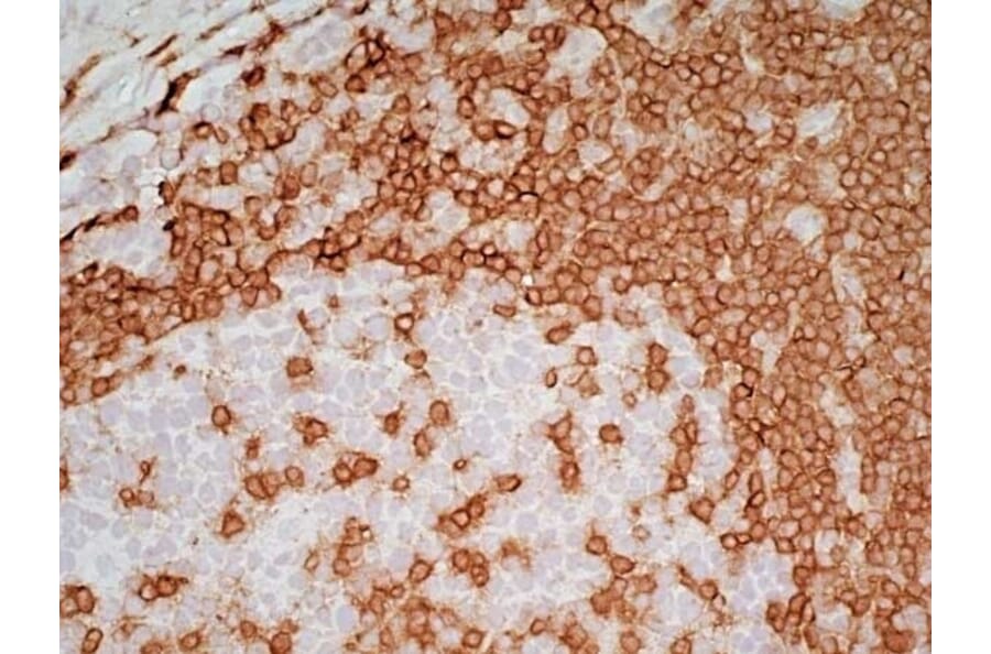 Immunohistochemistry - Goat Anti-Mouse IgG2a Antibody (HRP) (A282596) - Antibodies.com
