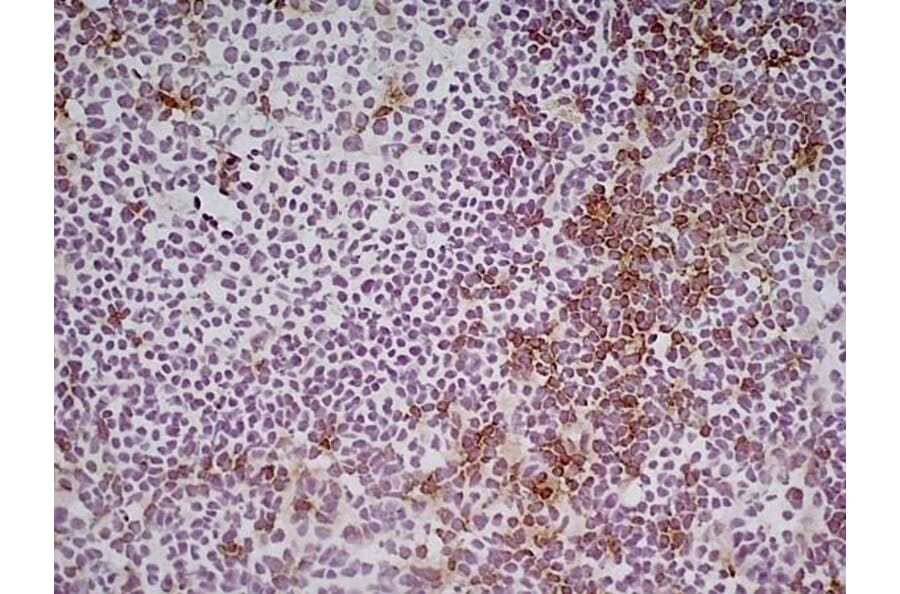 Immunohistochemistry - Goat Anti-Rat IgG Antibody (HRP), Cross-Adsorbed (A282612) - Antibodies.com