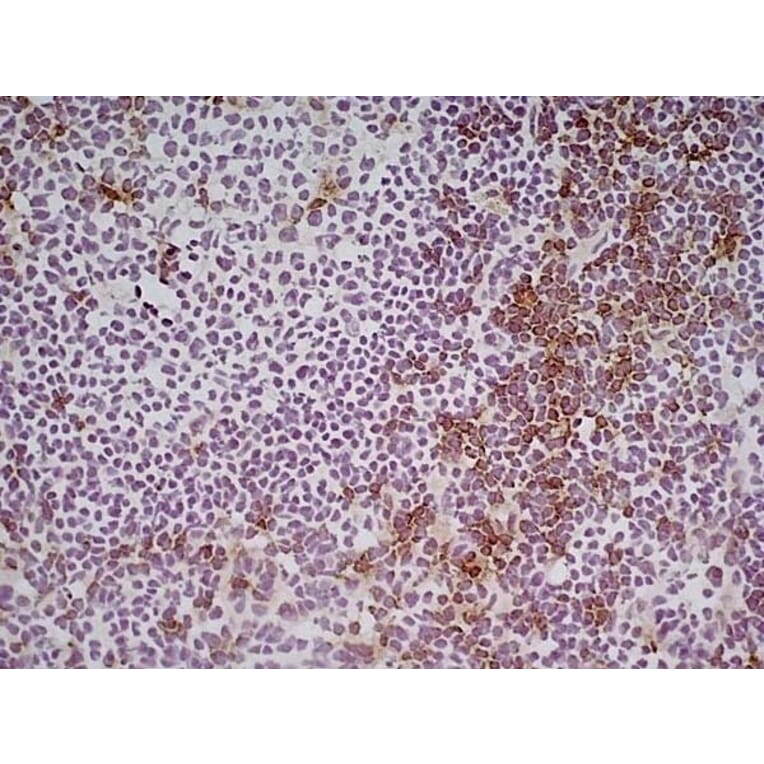 Immunohistochemistry - Goat Anti-Rat IgG Antibody (HRP), Cross-Adsorbed (A282612) - Antibodies.com
