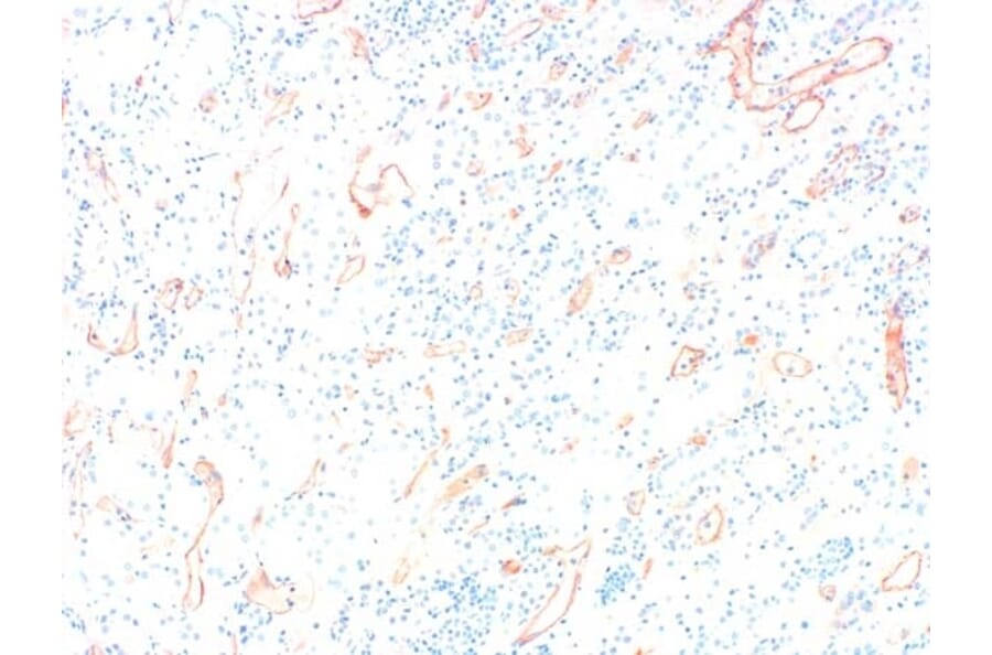 Immunohistochemistry - Anti-C4d Antibody (A282705) - Antibodies.com