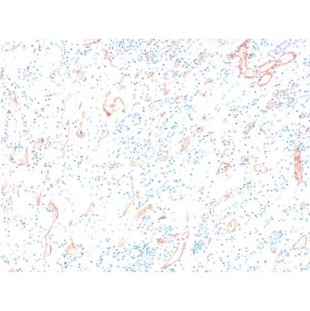 Immunohistochemistry - Anti-C4d Antibody (A282705) - Antibodies.com